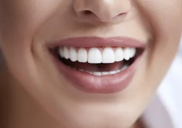 Dental Bonding