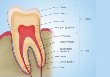 Root Canals